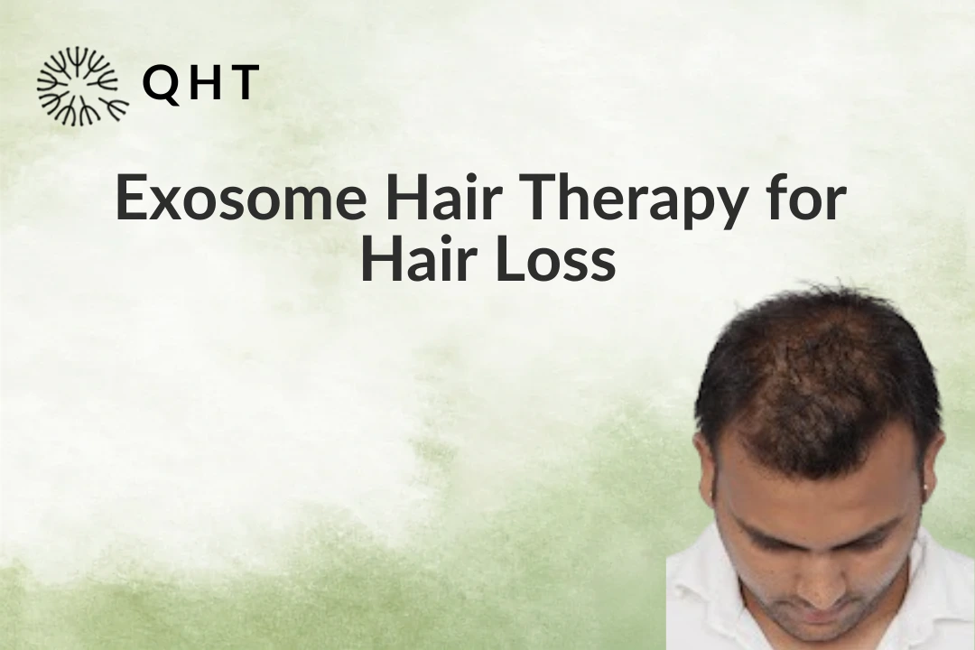 Exosome Hair Therapy