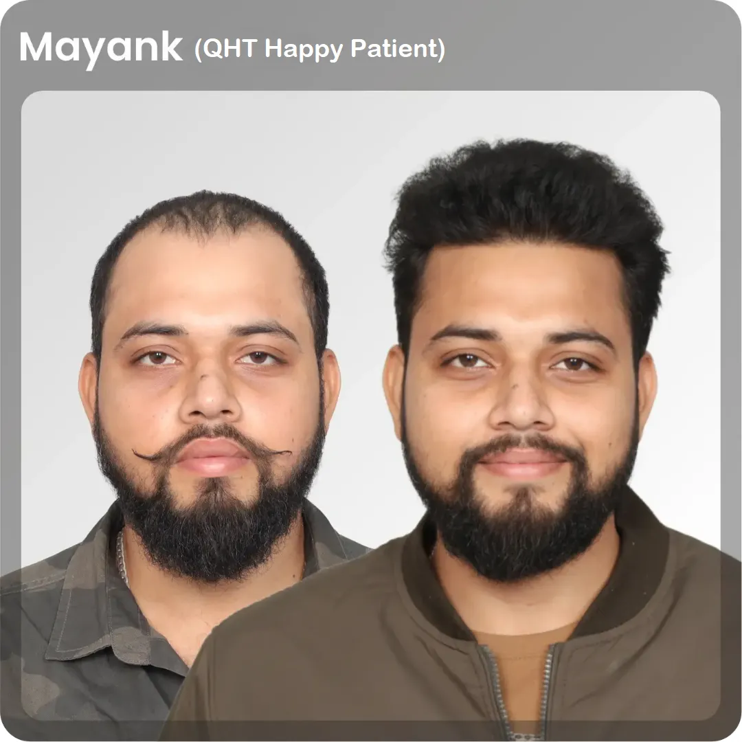 Mayank