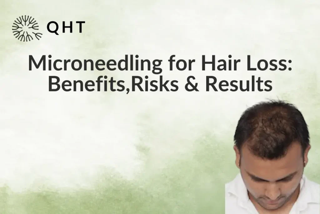 Microneedling for Hair Loss