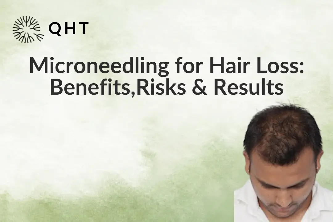Microneedling for Hair Loss