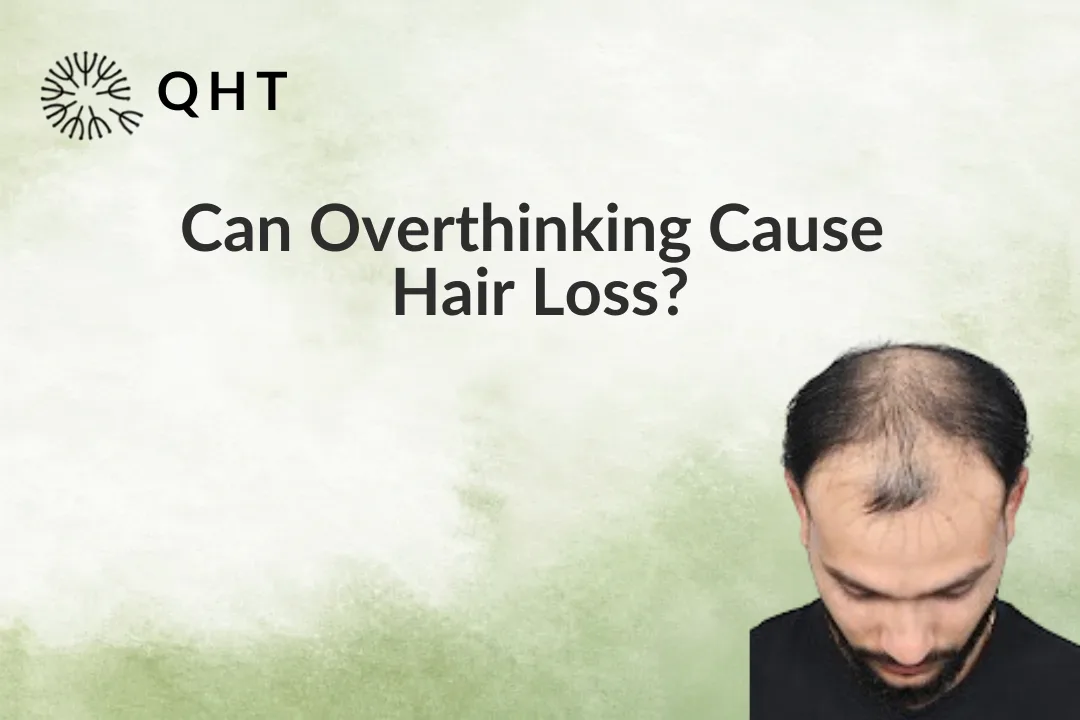 Can Overthinking Cause Hair Loss?