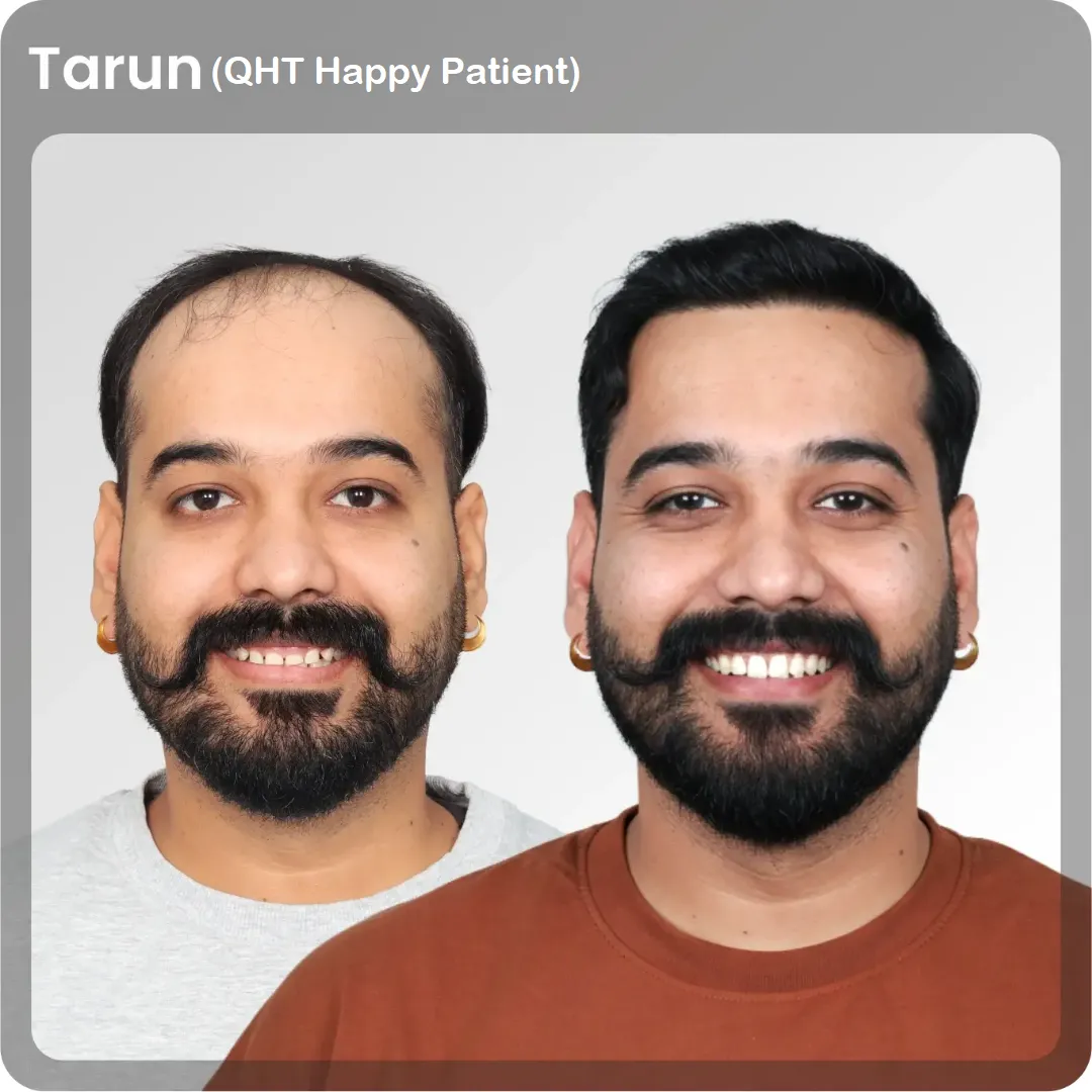 Tarun