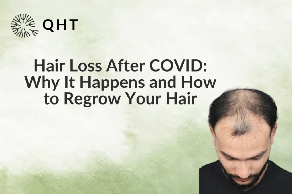 Hair loss after covid