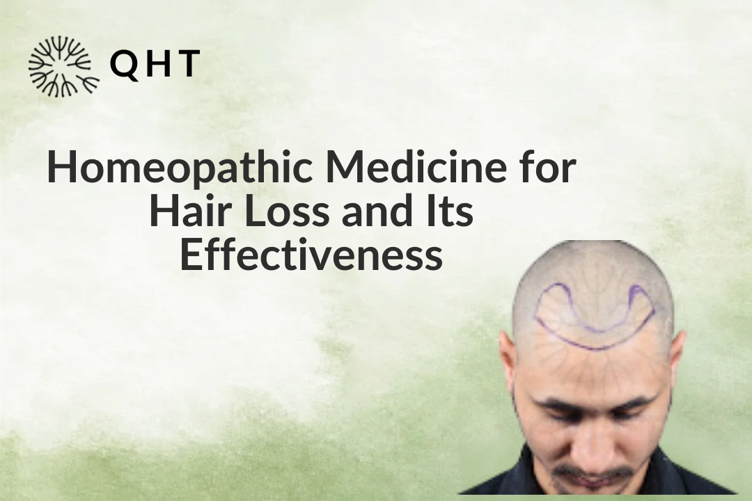 Homeopathic Medicine for Hair Loss and Its Effectiveness