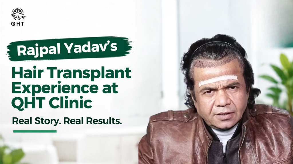 Rajpal Yadav hair transplant experience at QHT
