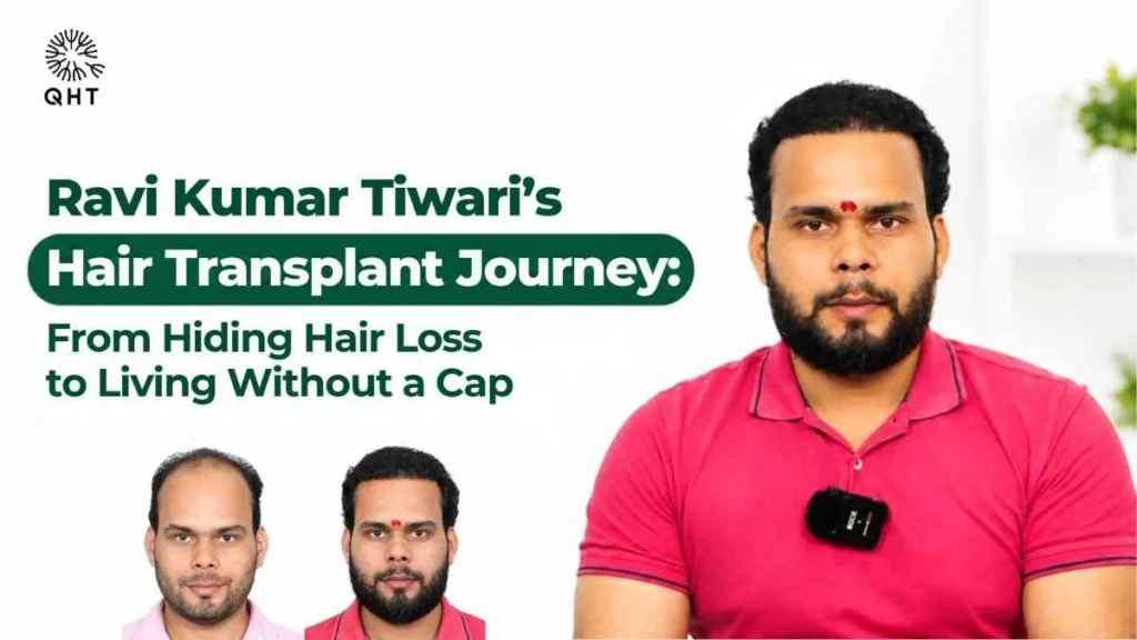 hair transformation